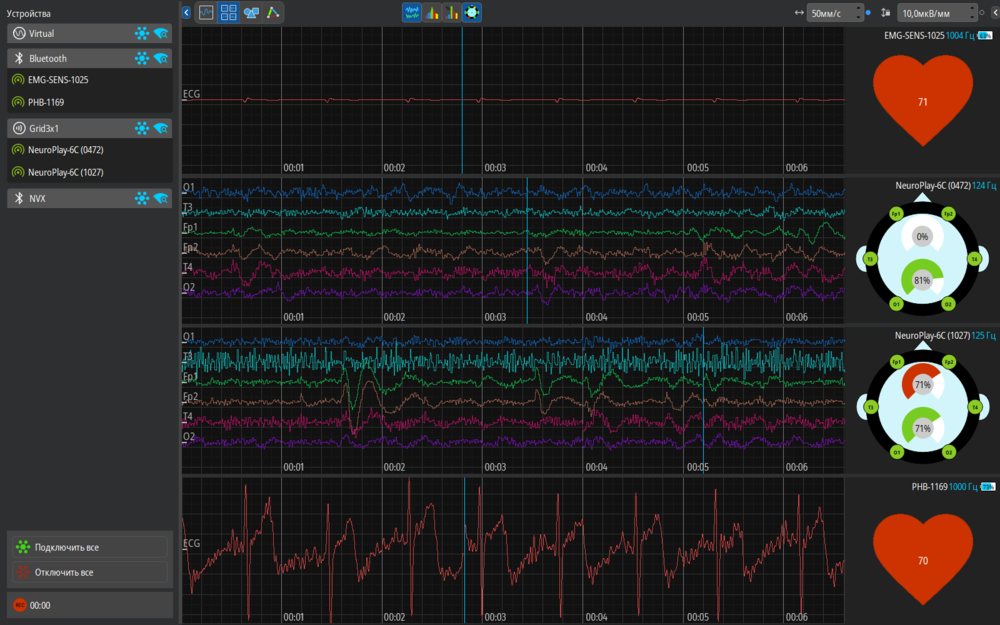 ECG and pulse analysis in LabStudio