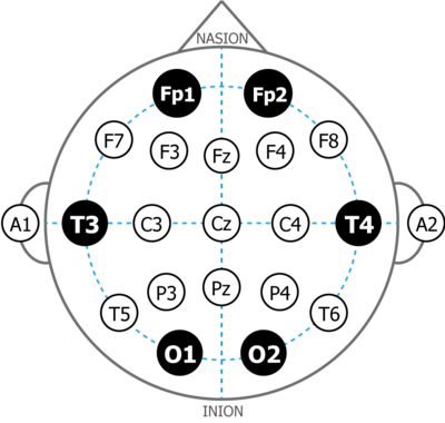 NeuroPlay-6C - схема отведений